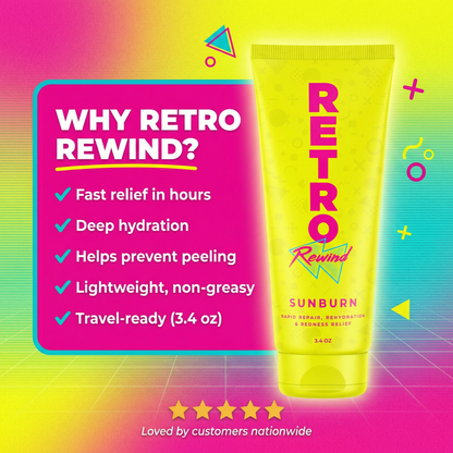REWIND SUNBURN
