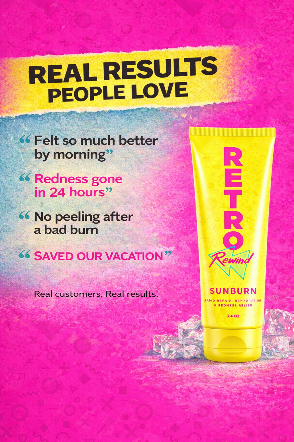 REWIND SUNBURN